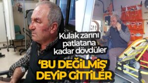 Kulak zarını patlatana kadar dövdüler, ‘Bu değilmiş’ deyip gittiler