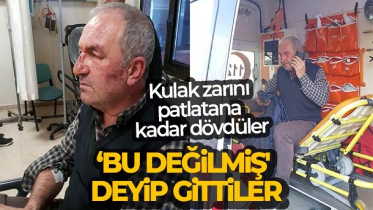 Kulak zarını patlatana kadar dövdüler, ‘Bu değilmiş’ deyip gittiler