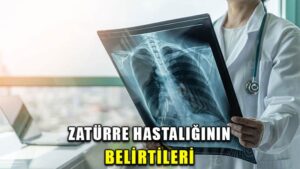 Zatürre hastalığının belirtileri
